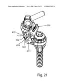 Facet Joint Replacement diagram and image