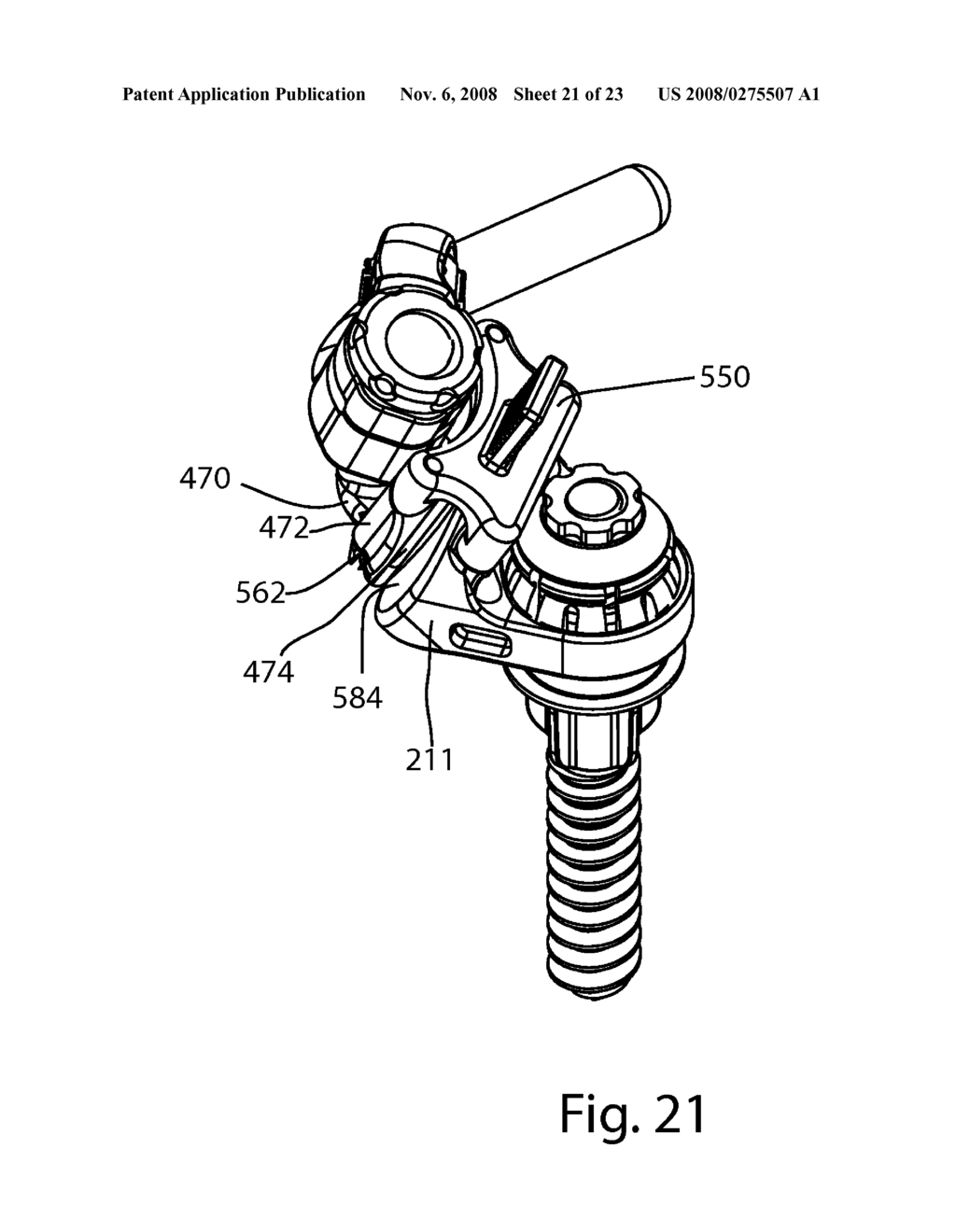 Facet Joint Replacement - diagram, schematic, and image 22