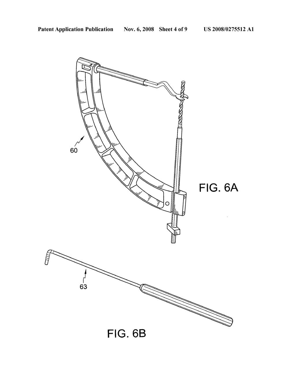 Arthroscopic unicompartmental knee technique and instrumentation - diagram, schematic, and image 05