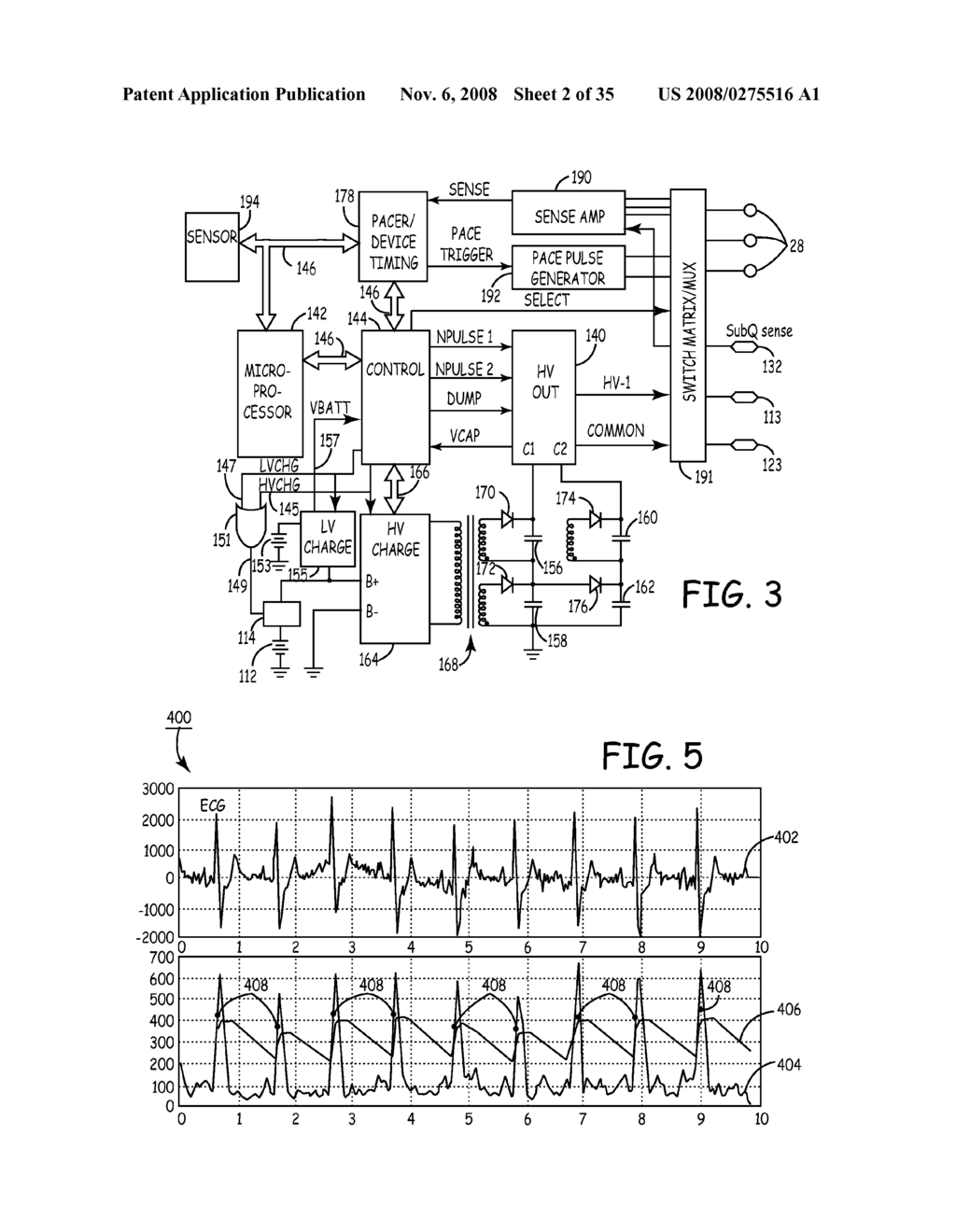METHOD AND APPARATUS FOR DETECTING ARRHYTHMIAS IN A MEDICAL DEVICE - diagram, schematic, and image 03