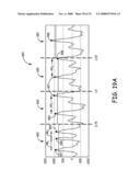 METHOD AND APPARATUS FOR DETECTING ARRHYTHMIAS IN A MEDICAL DEVICE diagram and image