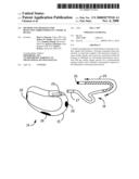 METHOD AND APPARATUS FOR DETECTING ARRHYTHMIAS IN A MEDICAL DEVICE diagram and image