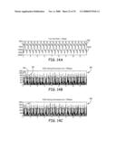 METHOD AND APPARATUS FOR DETECTING ARRHYTHMIAS IN A MEDICAL DEVICE diagram and image