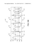 METHOD AND APPARATUS FOR DETECTING ARRHYTHMIAS IN A MEDICAL DEVICE diagram and image