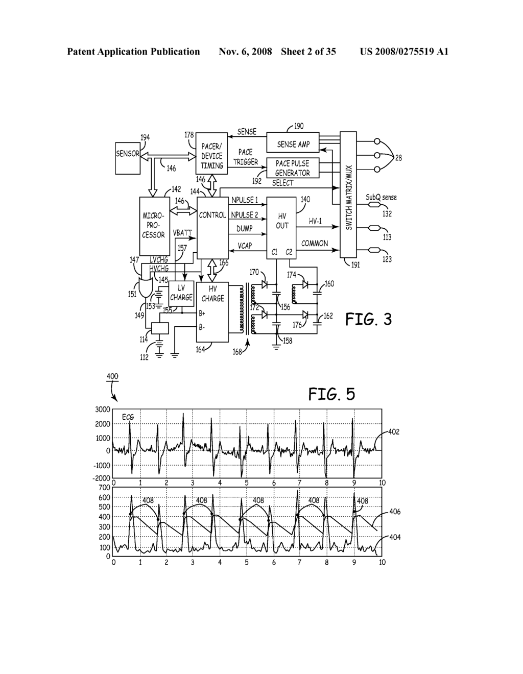 METHOD AND APPARATUS FOR DETECTING ARRHYTHMIAS IN A MEDICAL DEVICE - diagram, schematic, and image 03