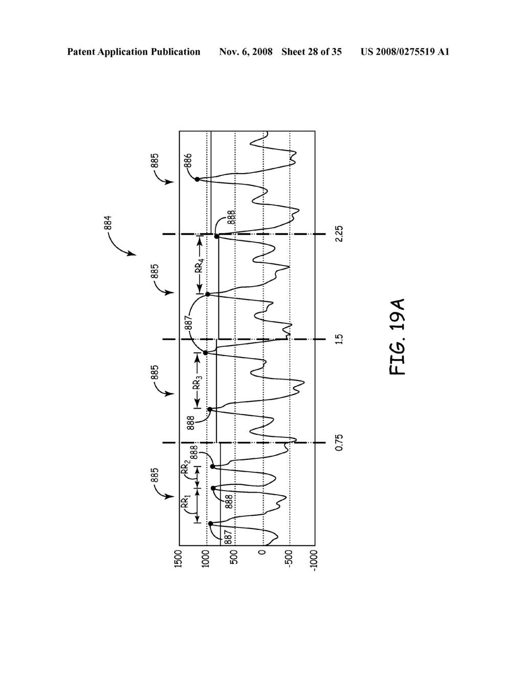 METHOD AND APPARATUS FOR DETECTING ARRHYTHMIAS IN A MEDICAL DEVICE - diagram, schematic, and image 29