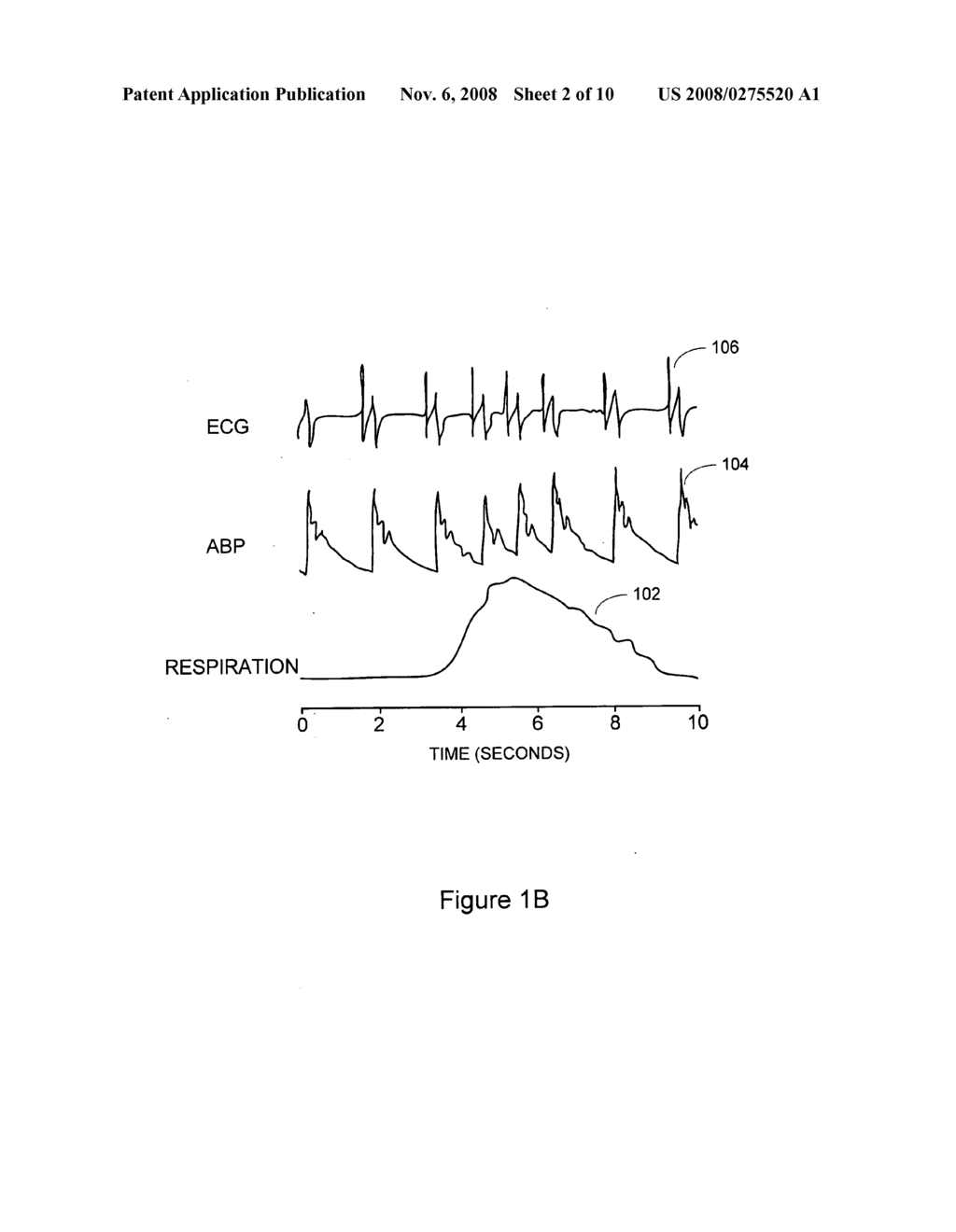 Automatic modulation of pacing timing intervals using beat to beat measures - diagram, schematic, and image 03