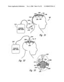 Methods and Apparatus for Effectuating a Lasting Change in a Neural Function of a Patient, Including Via Mechanical Force on Neural Tissue diagram and image