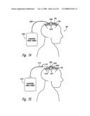 Methods and Apparatus for Effectuating a Lasting Change in a Neural Function of a Patient, Including Via Mechanical Force on Neural Tissue diagram and image