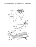 Methods and Apparatus for Effectuating a Lasting Change in a Neural Function of a Patient, Including Via Mechanical Force on Neural Tissue diagram and image