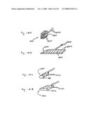 Methods and Apparatus for Effectuating a Lasting Change in a Neural Function of a Patient, Including Via Mechanical Force on Neural Tissue diagram and image