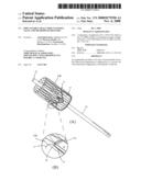 Implantable small percutaneous valve and methods of delivery diagram and image