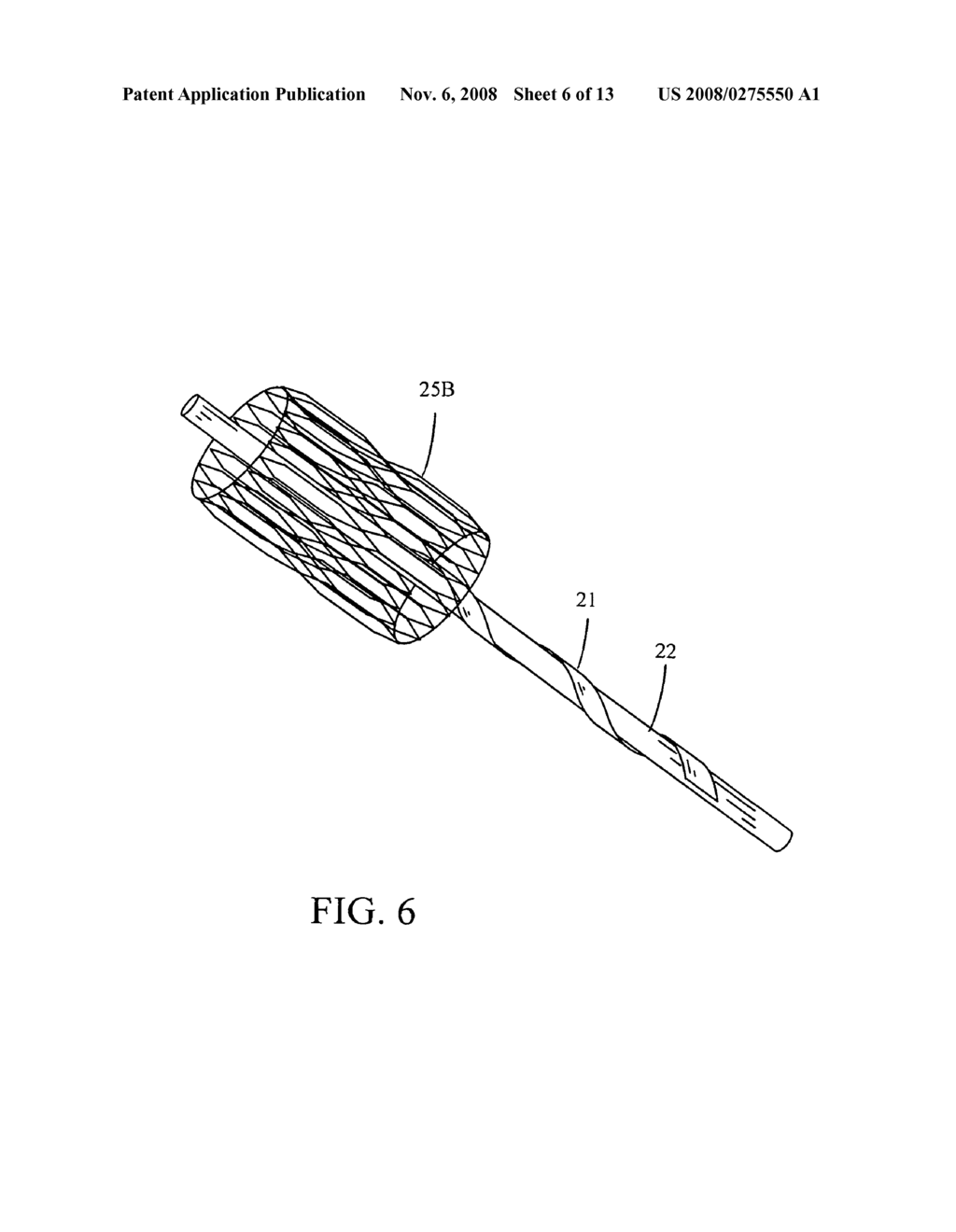 Implantable small percutaneous valve and methods of delivery - diagram, schematic, and image 07