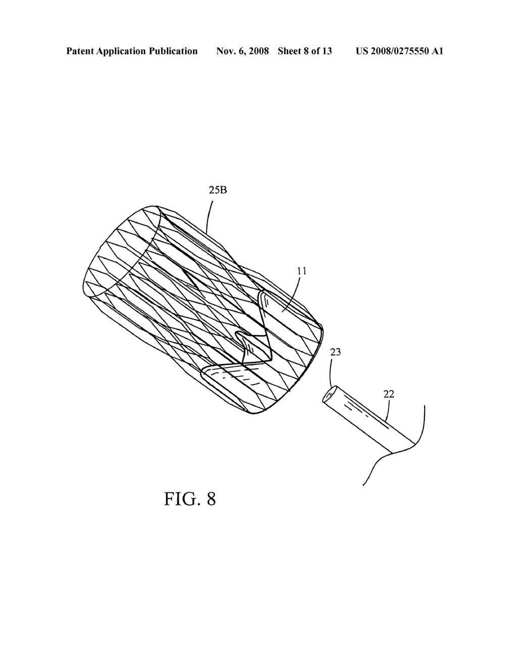 Implantable small percutaneous valve and methods of delivery - diagram, schematic, and image 09