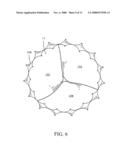 Implantable small percutaneous valve and methods of delivery diagram and image