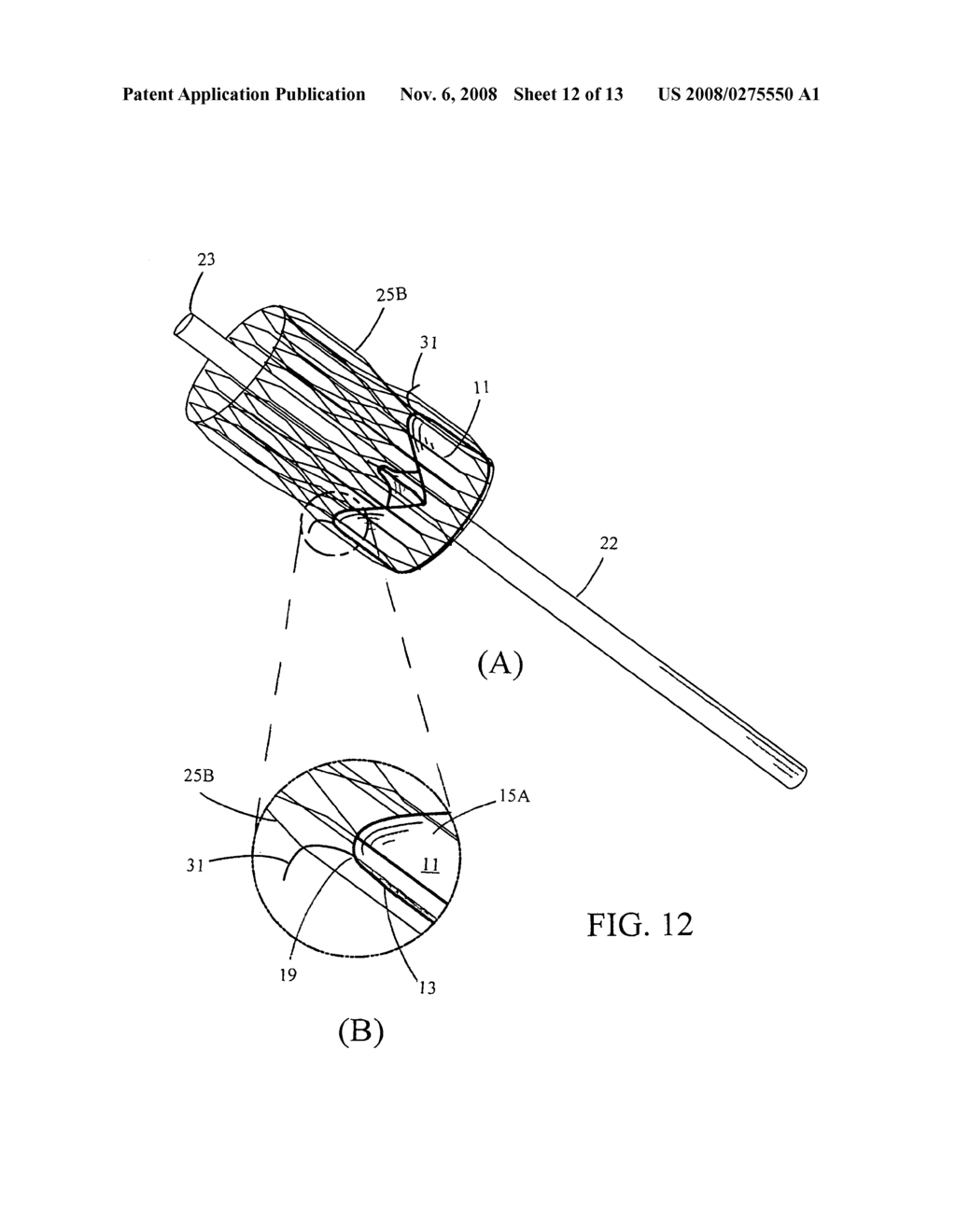 Implantable small percutaneous valve and methods of delivery - diagram, schematic, and image 13