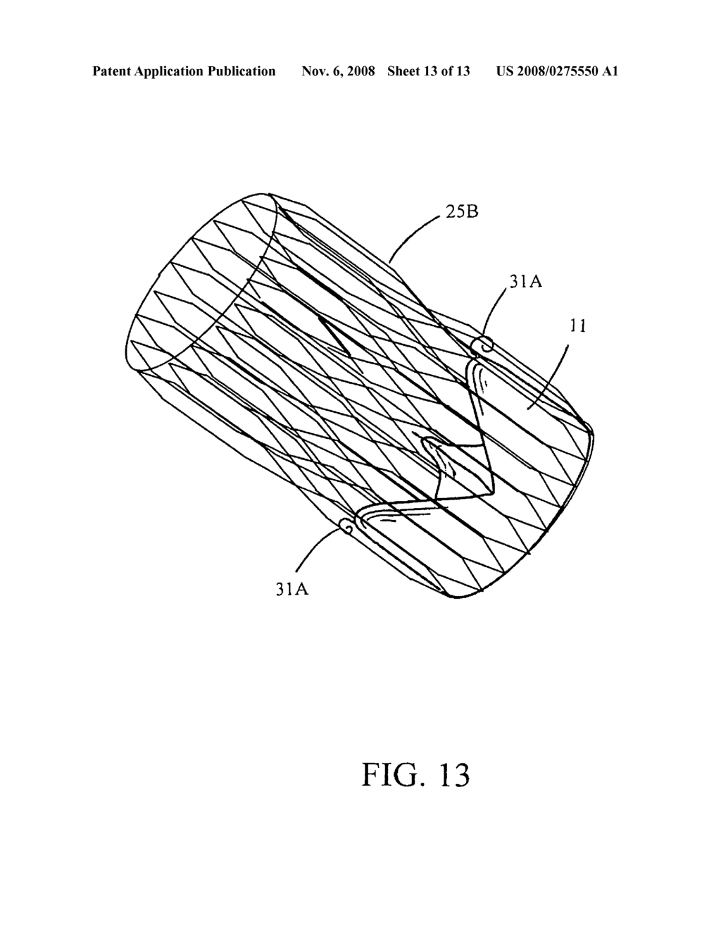 Implantable small percutaneous valve and methods of delivery - diagram, schematic, and image 14