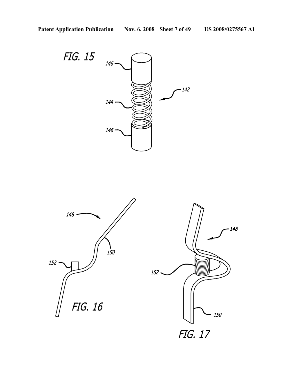 Extra-Articular Implantable Mechanical Energy Absorbing Systems - diagram, schematic, and image 08