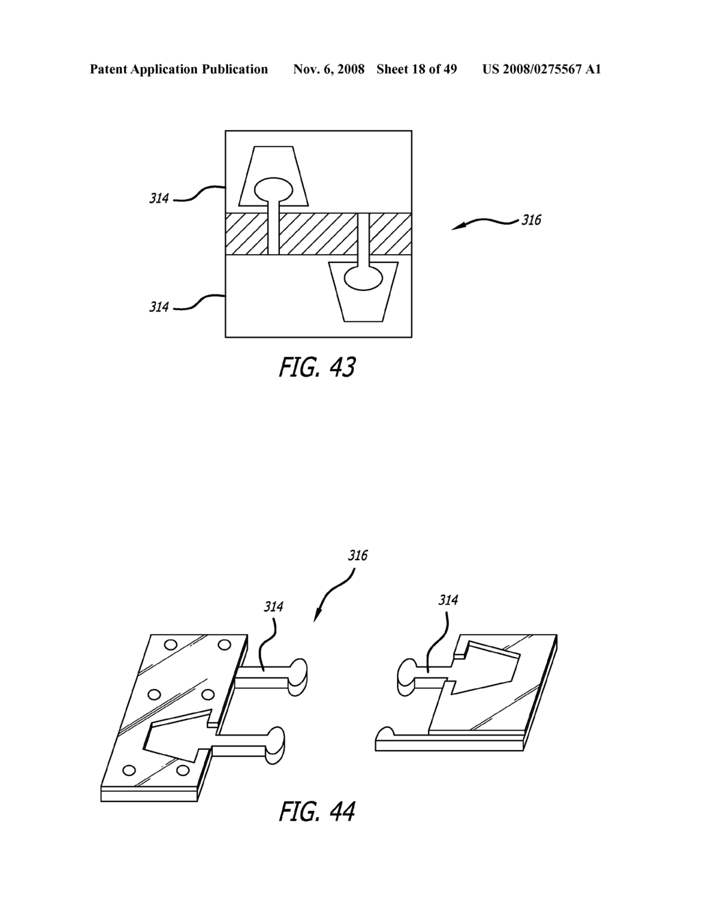 Extra-Articular Implantable Mechanical Energy Absorbing Systems - diagram, schematic, and image 19