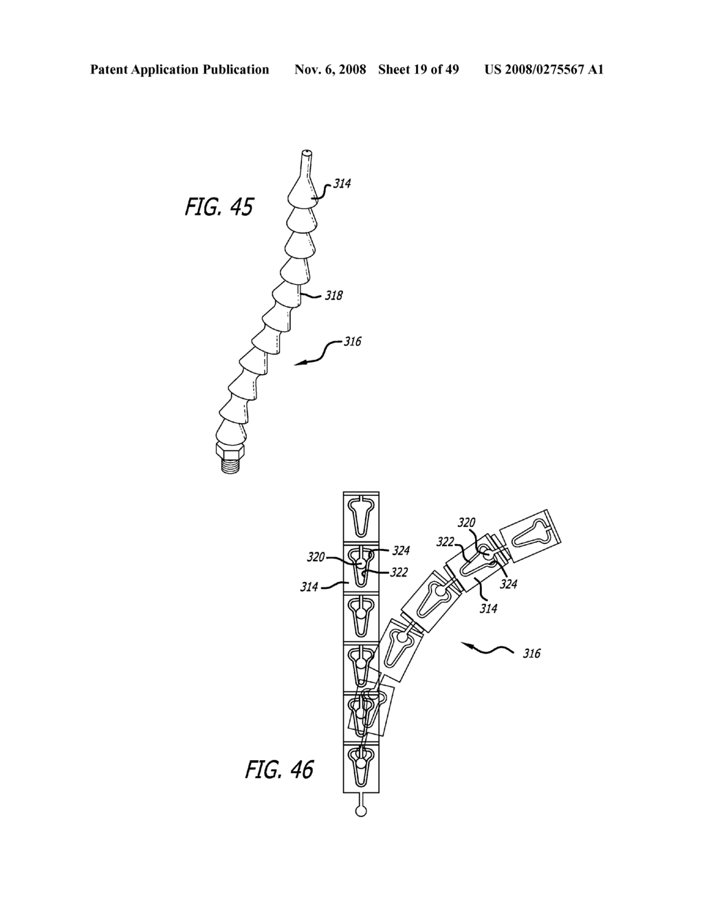 Extra-Articular Implantable Mechanical Energy Absorbing Systems - diagram, schematic, and image 20