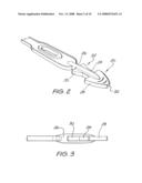 Securing Strap diagram and image