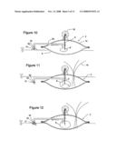 RENEWABLY BUOYANT, SELF-PROTECTIVE FLOATING HABITAT diagram and image