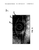 Eye-safe near infra-red imaging illumination method and system diagram and image