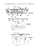 Driver Side Aspirated Airbags diagram and image