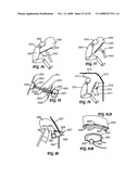 Driver Side Aspirated Airbags diagram and image