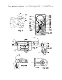 Driver Side Aspirated Airbags diagram and image