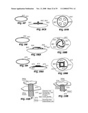 Driver Side Aspirated Airbags diagram and image