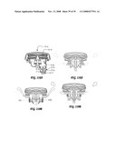 Driver Side Aspirated Airbags diagram and image