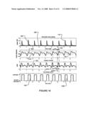 Methods and apparatus for harvesting biomechanical energy diagram and image