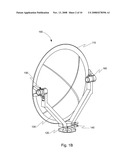 Worm Gear Azimuth Adjustment of a Parabolic Antenna diagram and image