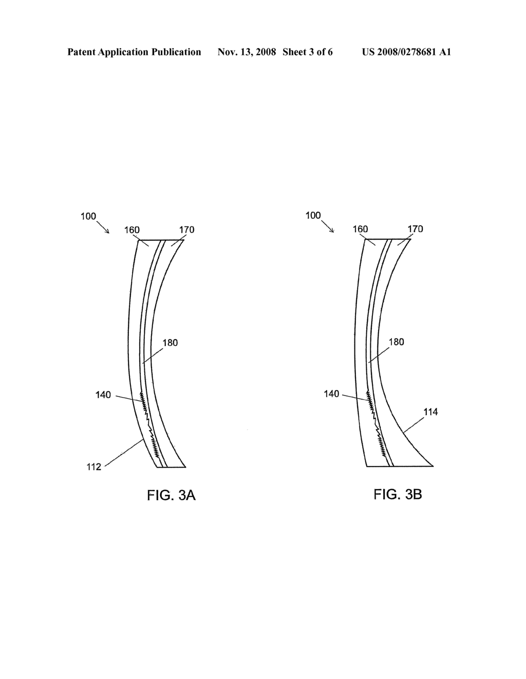 PROGRESSIVE ADDITION LENS OPERATING IN COMBINATION WITH A MULTI-ORDER DIFFRACTIVE OPTIC - diagram, schematic, and image 04