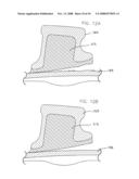 Expandable Joint diagram and image