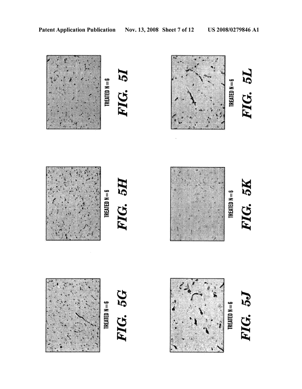 METHODS OF TREATMENT AND PREVENTION OF NEURODEGENERATIVE DISEASES AND DISORDERS - diagram, schematic, and image 08