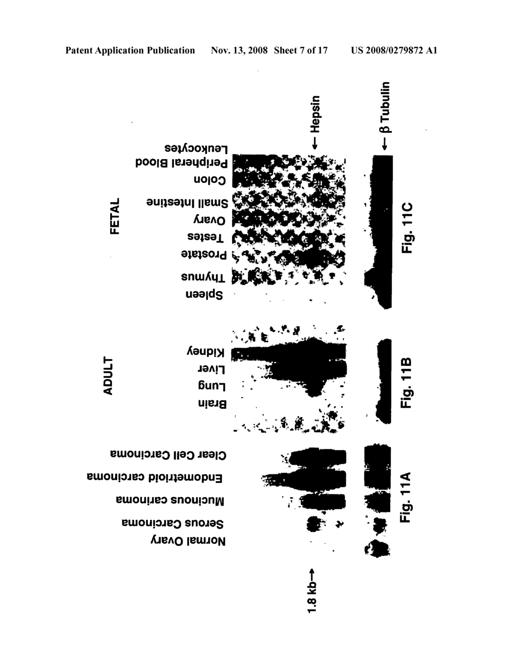 Immunotherapeutic methods targeted toward stratum corneum chymotryptic enzyme - diagram, schematic, and image 08