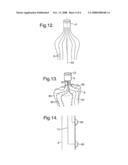 Dental Electrode Assembly diagram and image