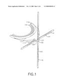 Facial plane relator diagram and image