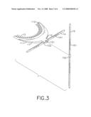 Facial plane relator diagram and image