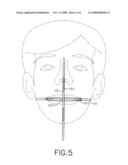 Facial plane relator diagram and image