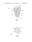 Molar Implant and Method diagram and image