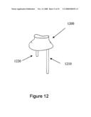 Methods for Producing Non-Interfering Tooth Models diagram and image