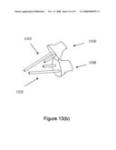 Methods for Producing Non-Interfering Tooth Models diagram and image