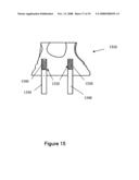 Methods for Producing Non-Interfering Tooth Models diagram and image