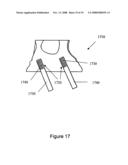 Methods for Producing Non-Interfering Tooth Models diagram and image