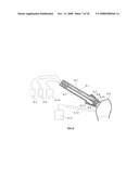 Method and Apparatus for Tooth Rejuvenation and Hard Tissue Modification diagram and image