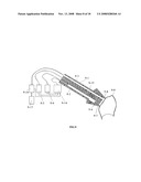 Method and Apparatus for Tooth Rejuvenation and Hard Tissue Modification diagram and image