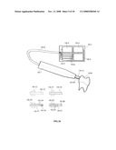 Method and Apparatus for Tooth Rejuvenation and Hard Tissue Modification diagram and image